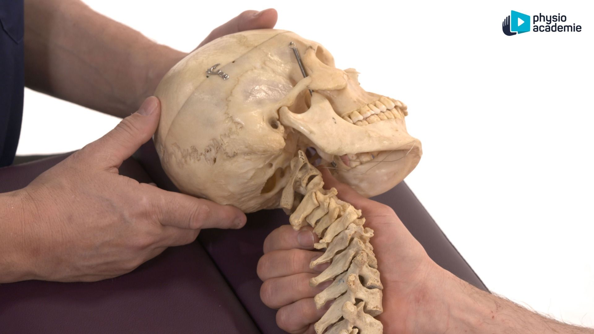 Occipital