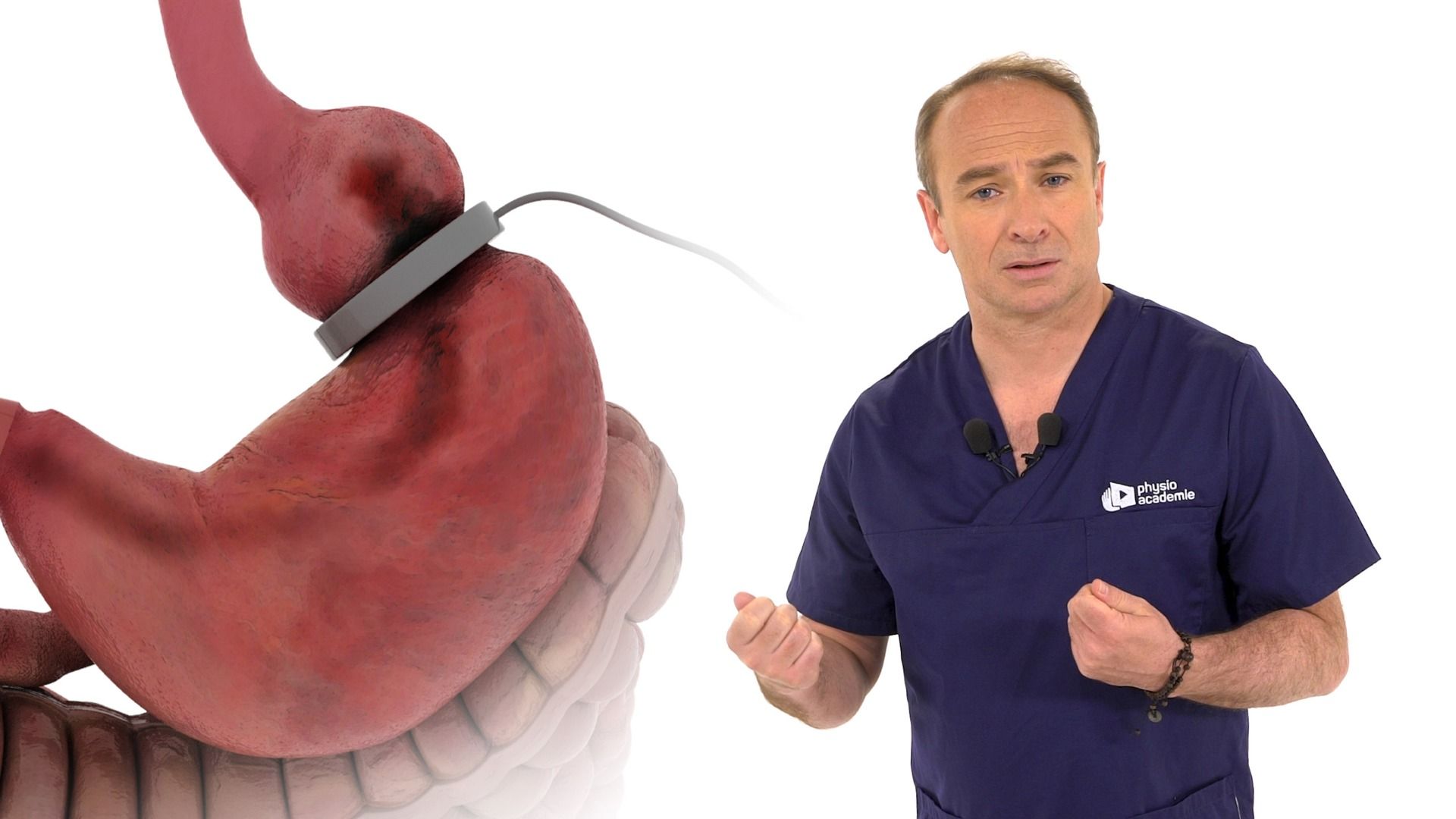 Chirurgie bariatrique