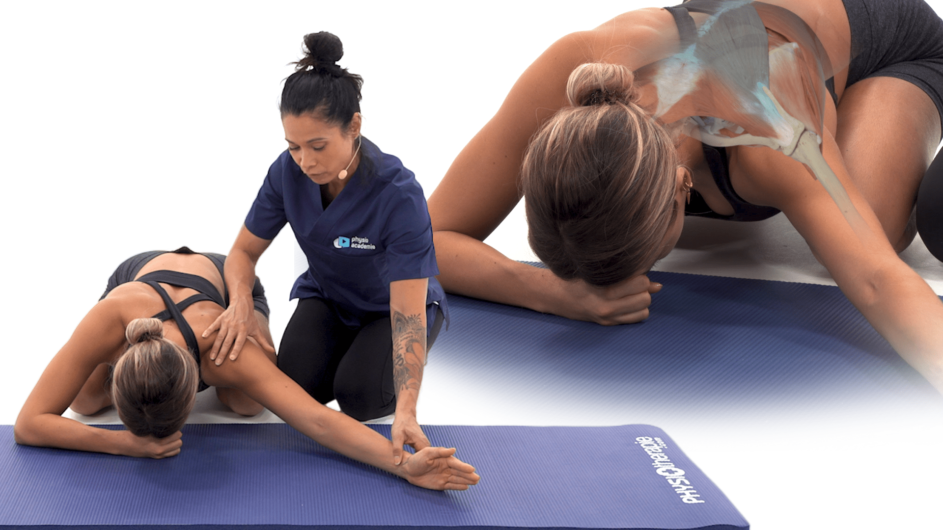 Tendinopathie de la coiffe des rotateurs - Phase 2