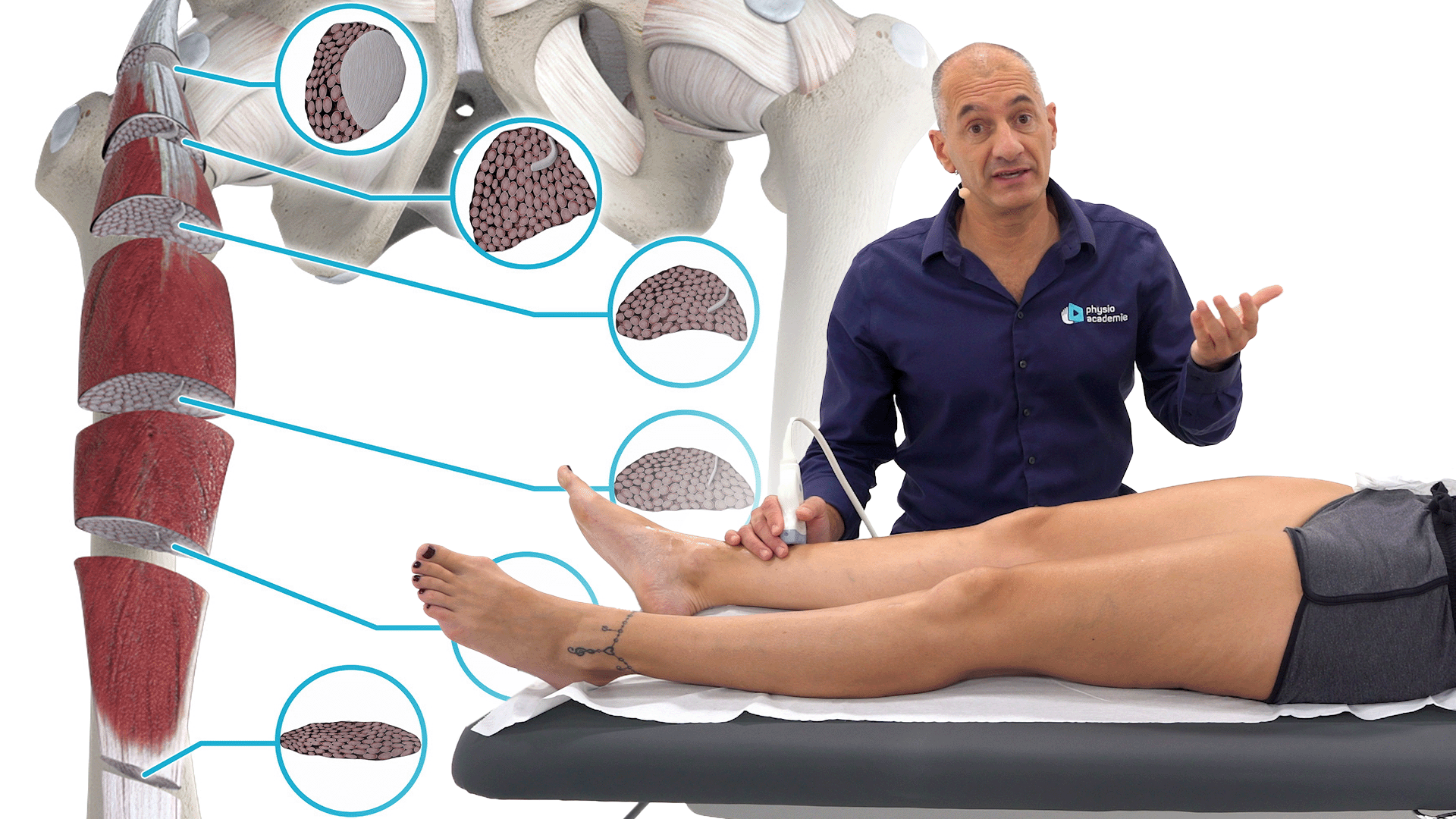 Lésion musculaire : échographie du quadriceps