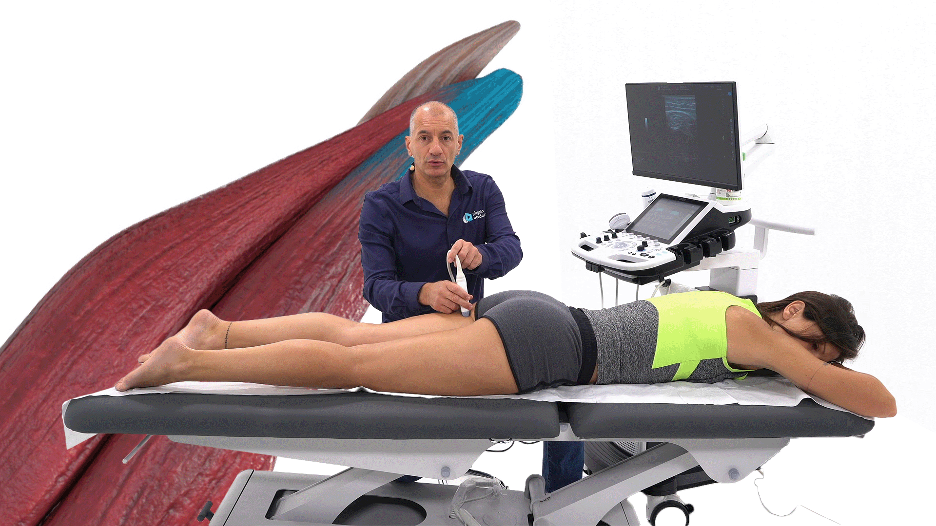 Lésion musculaire : échographie ischio-jambiers