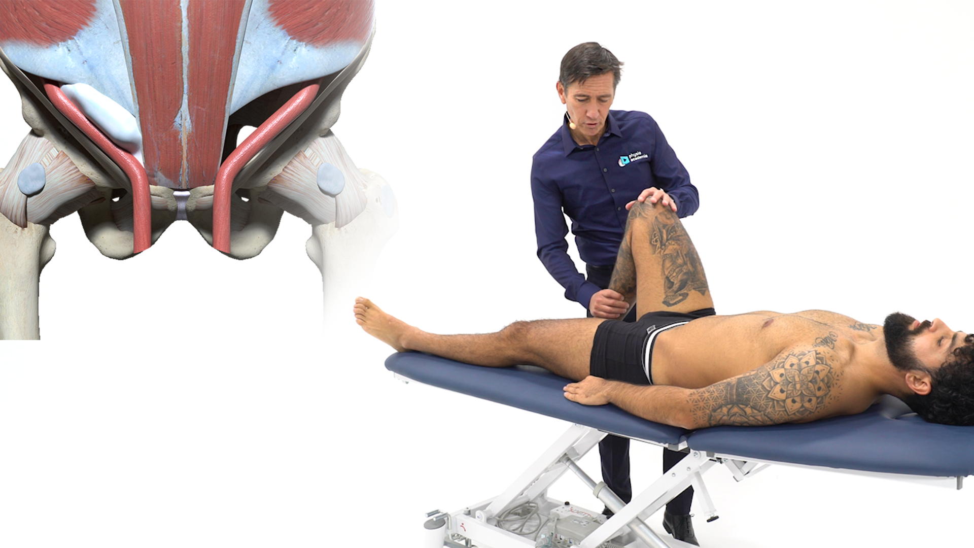 Diagnostic et chirurgie de la pubalgie du sportif