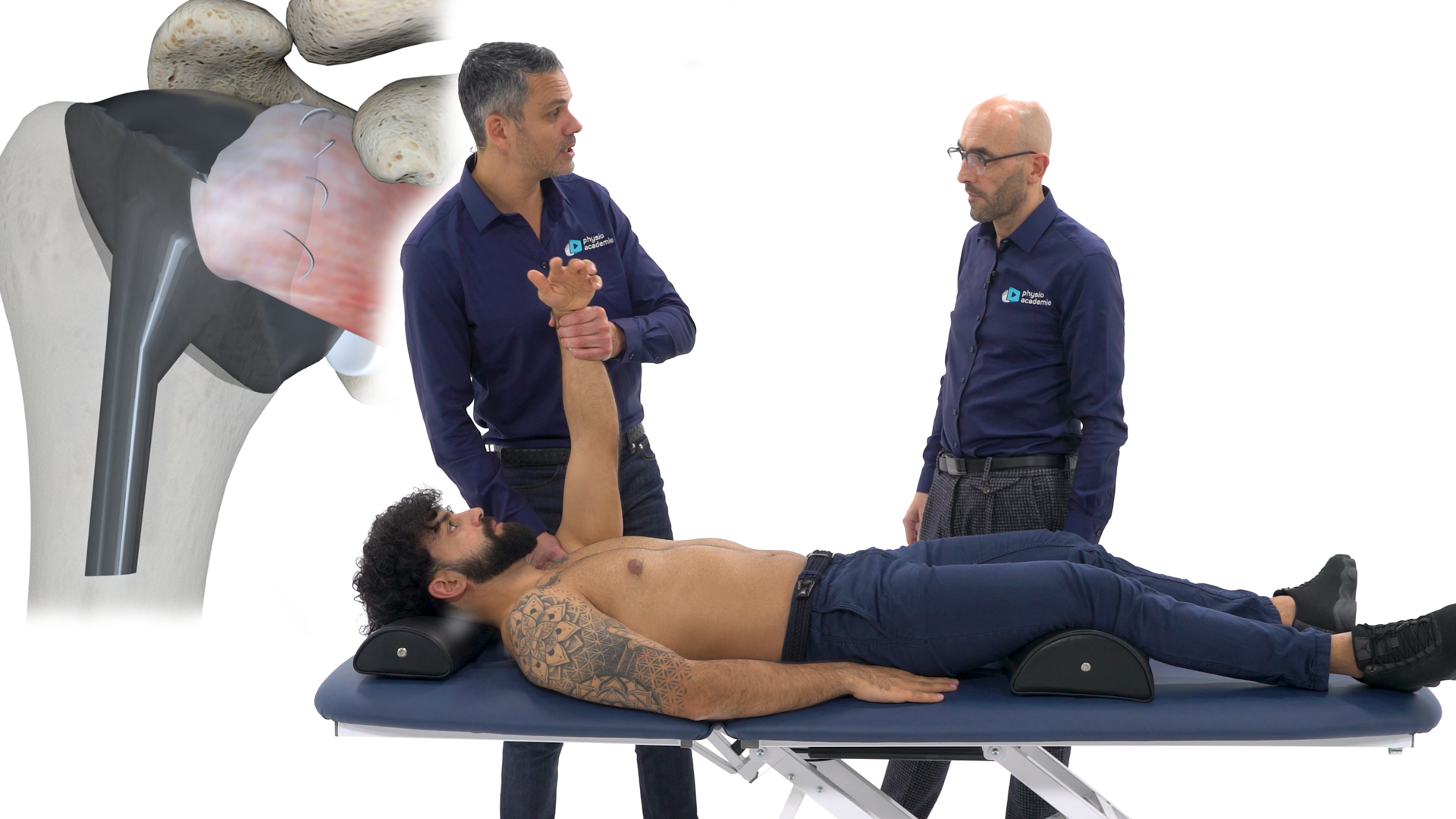 Prothèse d’épaule : de la chirurgie à la rééducation