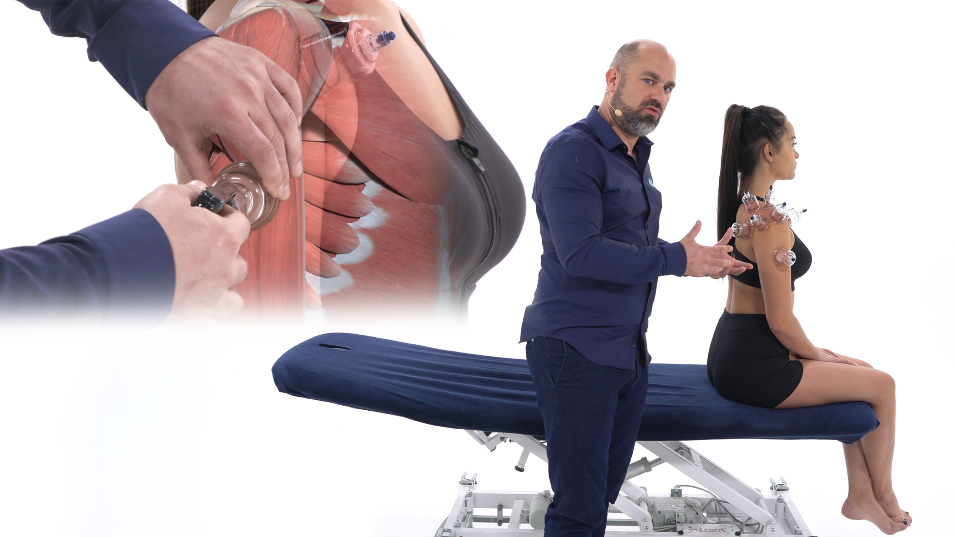 Technique des ventouses