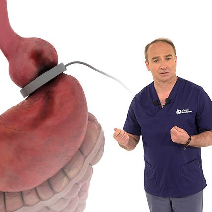Chirurgie bariatrique