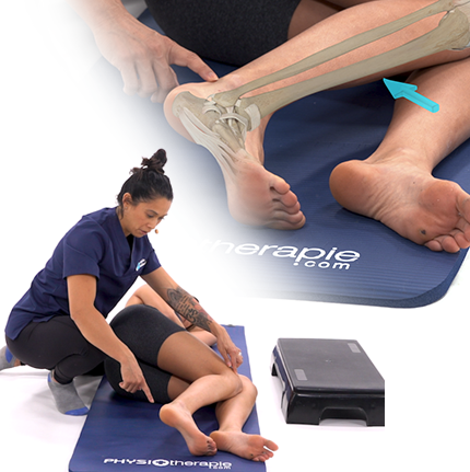 Tendinopathie Fémoro patéllaire