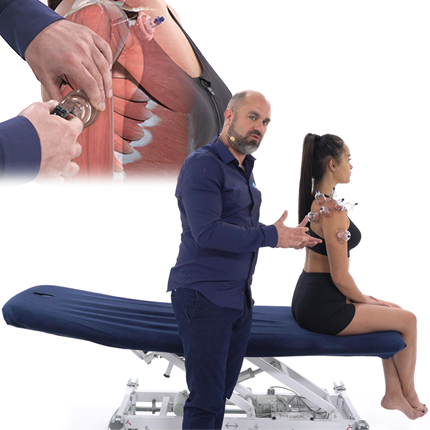 Technique des ventouses